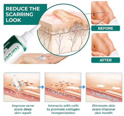 Furzero™ Advanced medical-grade scar gel with stem cells